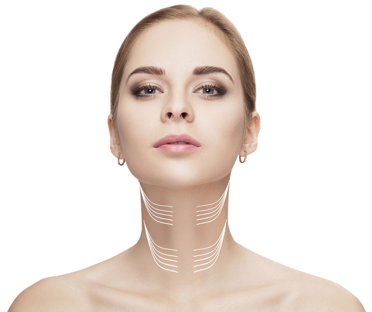 Referencia visual de lifting de cuello