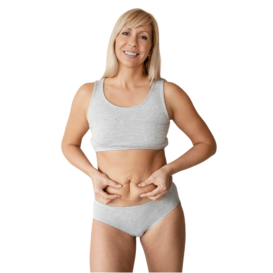 Referencia visual de abdominoplastia