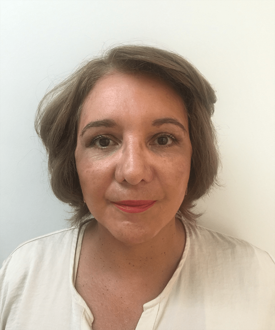 Despues de lifting facial - caso 1